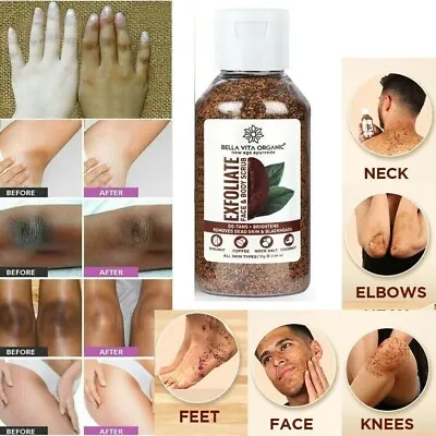 Coffee Scrub For Face Body Neck Knees Blackhead Remover Tan Dirt Removal 75 Gm • $29.72