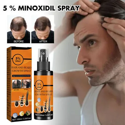 5 % Minoxidil Hair Growth Spray For Men Women 100ml Treatment Regrowth Hair UK • £6.59