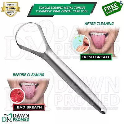 Tongue Scraper Metal Tongue Cleaner 6  Oral Dental Care Instrument German Grade • $5.98