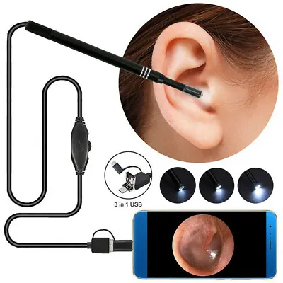 LED USB Endoscope Otoscope Ear Camera Scope Ear Wax Removal Kit Earwax Cleaning • £8.03
