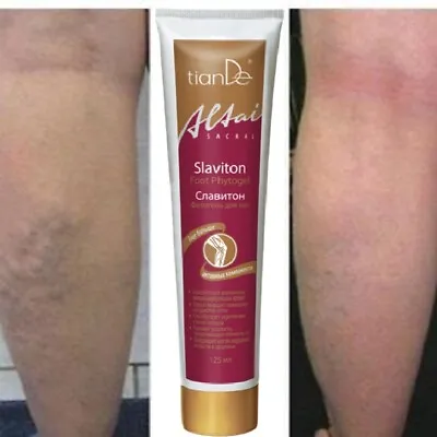 Varicose Veins Legs Cream Sore Restless Massage Gel Slaviton TianDe 125 Ml • £15.60