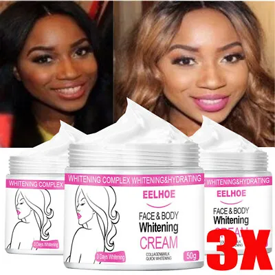 $15.45 • Buy 3Pcs Dark Skin Whitening Lightening Brightening Serum Dark Spot Bleaching Cream