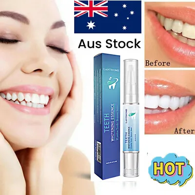 $9.46 • Buy Teeth Tooth Whitening Gel Pen White Bleaching Dental Whitener White Teeth 2022 D