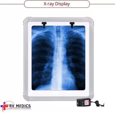 LED X-Ray Film Viewer Box SMALL(14''X17'') LARGE (14''X28'') • $179.90