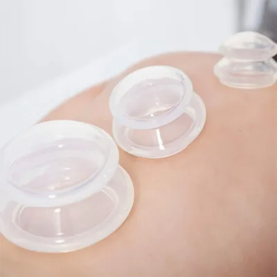 Silicone Vacuum Cupping Set Massage Body Cups Back Gua Sha Ventosas Suction CTM • £12.60