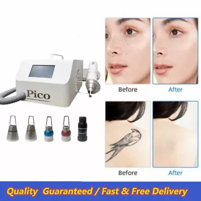 Portable Picosecond Q Switch Nd Yag Laser Tattoo /Spot/Eyebrow Removal Machine • £400.99