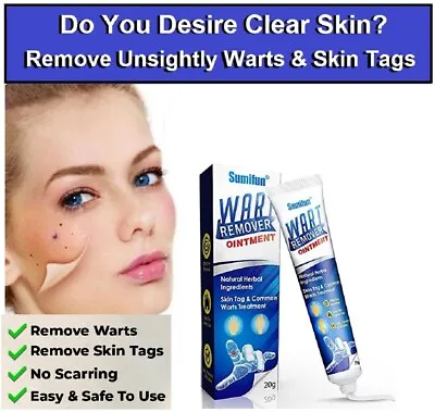 Wart Remover Cream Ointment Skin Tag Natural Treatment Moles Safe Verruca • £12.99