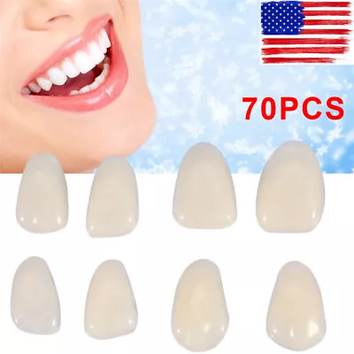 70PCS Ultra Thin Whitening Denture Patch Fake Teeth Gap Temporary Repair Veneers • $8.12