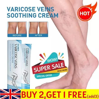 New Raura Varicose Veins Cream Raura Varicose Veins Treatment Cream For Legs • £5.16