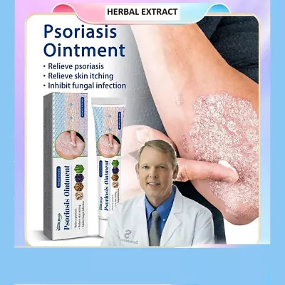 Psoriasis Eczema Treatment Cream Natural Dermatitis Ointment Care Tube Pack 20g • $25.99