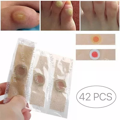 42 Pcs Foot Corn Remover Pads Plantar Wart Thorn Plaster Patch Callus Removal • £7.37