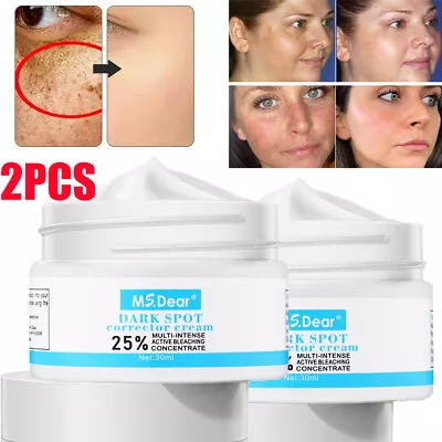 2PCS Whitening Freckle Cream Face Moisturizing Remove Dark Spots Melanin Melasma • $10.95