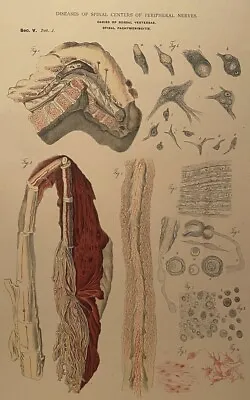 W M Donaldson & Co Vintage Anatomy Lithograph Print  • $144
