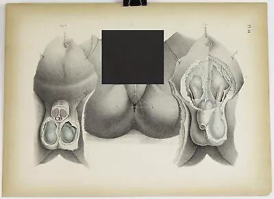 Medical Anatomy Colored Lithograph Print 1850s Vintage Antique 14.25x10.25 #50 • $44.19