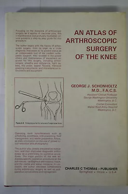 Atlas Arthroscopic Surgery Of The Knee Schonholtz (1988) HC/DJ Medicine • £16.09