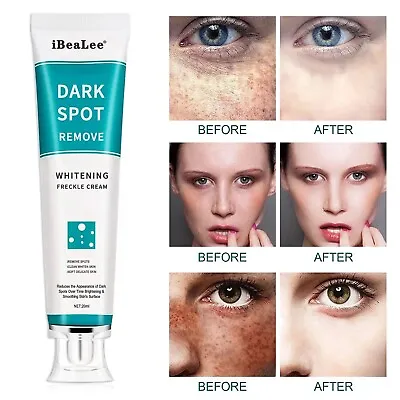 IBeaLee Whitening Freckle Cream Remove Melasma Dark Spots Cream Anti-Aging 20ml • £5.99