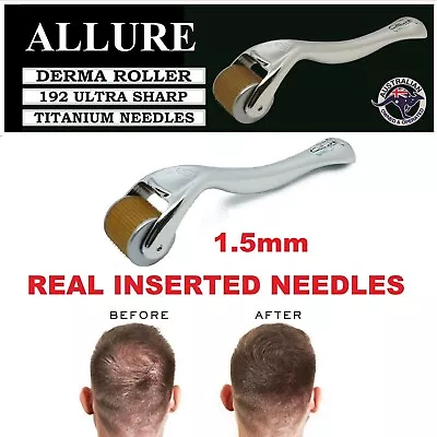 $18.36 • Buy Derma Roller Hair Beard Loss Baldness Treatment 192 Real Titanium Needles 1.5mm 