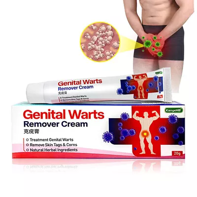 Genital Herpes Wart Remover Ointment Skin Tag Mole Acuminatum Treatment Cr Wi • £4.31