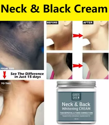 Dark Neck & Back Skin Instant Whitening Cream Reduce Hyperpigmentation & Melanin • $14.31