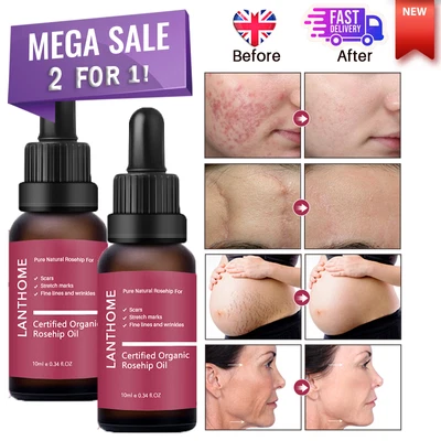 £7.55 • Buy 20ML🌟 Organic Rosehip Oil For Face, Use Of Scars, Stretch Marks & Wrinkles ✅🔥