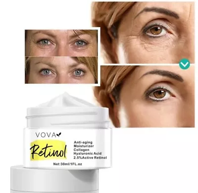 VOVA Retinol Anti Wrinkle Face Cream Collagen Hyaluronic Acid Shrink Pores Firmi • £6.99