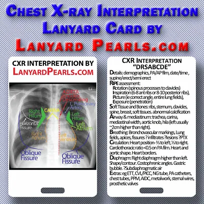 Chest X-Ray (CXR) Interpretation | Medical Lanyard Badge Card • $2.56