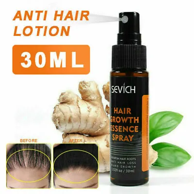 2pc Powerful Hair Growth Essential Oil Hair Loss Treatment Nourishing Care B • £8.99