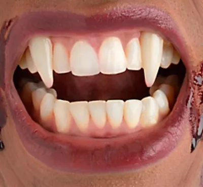 Vampire Fangs With Dental Appliance Putty Single Teeth Halloween  • £5.99