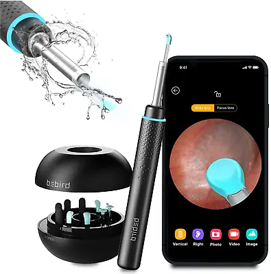 Ear Wax Removal Kit Smart Visual Camera Otoscope With Led Light Bbird M9 Pro • $19.99