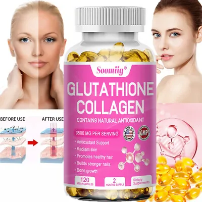 Glutathione 2000mg 120 Softgels & Collagen Skin Whitening Capsules Supplement • £9.02