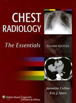 Chest Radiology: The Essentials • $7.29