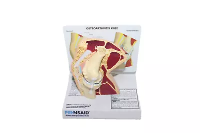 GPI Knee Model ~ Stages Of Osteoarthritis ~ Medical Teaching Dr Office Display  • $52.95