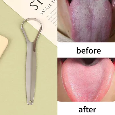 Stainless Steel Tongue Scraper Tongue Metal Cleaner Dental Oral Care ToYN • $1.37