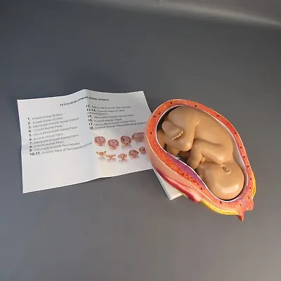 Educational Science 6th Month Human Fetus Model Medical Display 6  X 10  Figure • $48.01