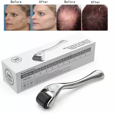 540 Titanium Micro Derma Roller 1.0 Mm For Acne Scars Wrinkles Beard Hair Loss • $8.99