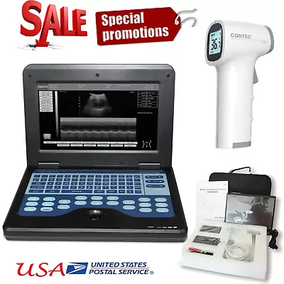 Portable Laptop Machine B-Ultrasound Scanner 3.5Mhz Convex Probe Abdomen US FDA • $1249