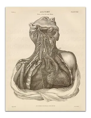 Anatomy NERVES OF THE NECK&THORAX PLATE XVII Vintage Illustration 22x17  Print • $20.99