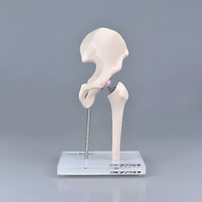 1/3 Artificial Hip Joint Replacement Medical Anatomical Skeleton Demo Model • $119.20