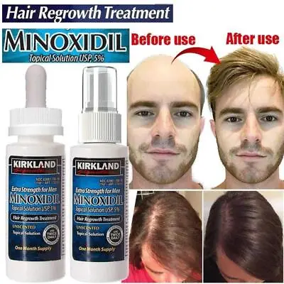 $9.95 • Buy 5% Extra Strength New Kirkland Minoxidil Men Hair Regrowth Solution Original