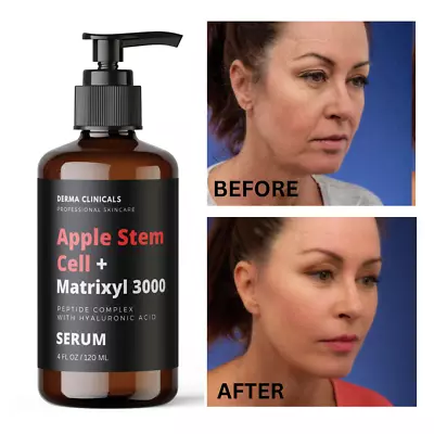 Hyaluronic Acid  Apple Stem-Cell + Matrixyl 3000 Peptide AntiAging Serum - 4 Oz • $24.99