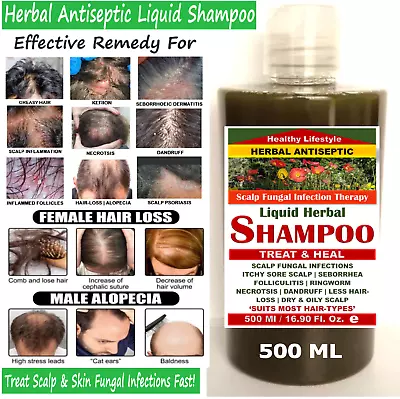 💚 Scalp Fungal Infections Fast Solution - ANTISEPTIC HERBAL SHAMPOO 500 ML💚 • £13.99