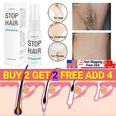 $7.59 • Buy Hair Removal Spray Stop Hair Growth Natural Painless Permanent Depilatory Cream