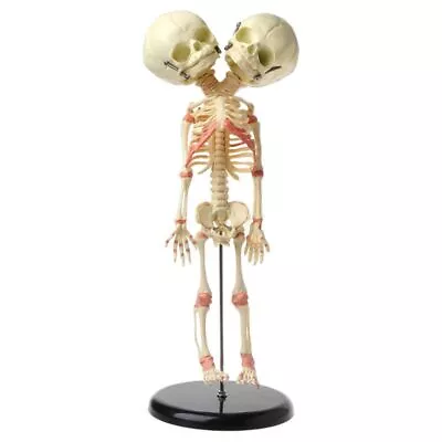 37cm Human Double For Head Baby Skull Skeleton Anatomy Brain Display Study Teach • £35.36