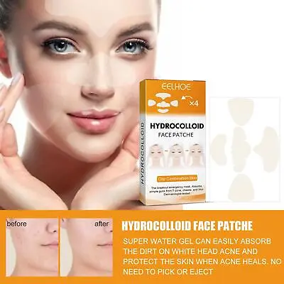 $2.51 • Buy 20x Mighty Patch Nose Pores Cleansing Cosmetics Hydrocolloid Patches S3I3