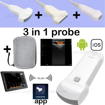 Wireless Color Doppler Ultrasound 3 In 1 Probe Dual Probe Linear Convex Free Bag • $1830