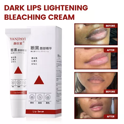 Lips Pink Fresh Fast Lightening Bleaching Cream Balm Treatment Remove Dark Lips • £5.99