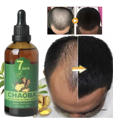 100ml 7Day Ginger Germinal Hair Growth Serum Hairdressing Oil Loss Treatment • $45