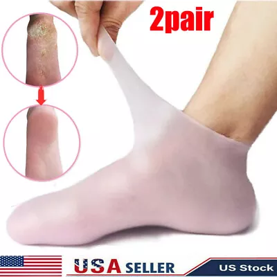 2 Pair Full Length Silicone Gel Moisturizing Socks Foot Care Protector Free Ship • $9.99