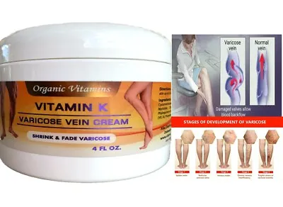 Vitamin K Cream For Spider Varicose Veins Scars Rosacea Capillaries  Serum CREAM • $14