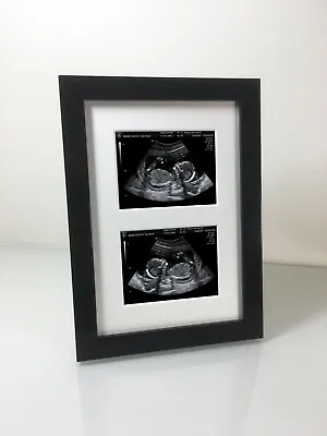 Twin Aperture Pregnancy Ultrasound Scan & 1st Photo Black Picture Frame • £10.95